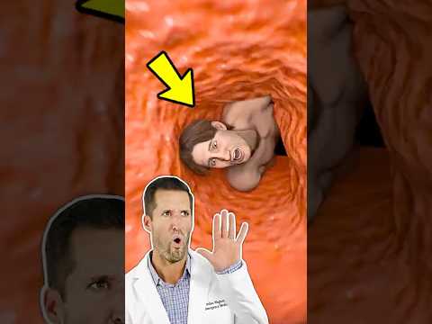 ER Doctor REACTS to Swallowed by a Sperm Whale (Zack D. Films)