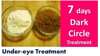 Remove Dark Circles in 7 days , Acne , Under eyes , Dark Circle Treatment