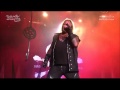Motley Crue - Dr Feelgood Live 2015 Vince looks like a fat Elvis!