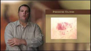 Caring for Bedridden Residents