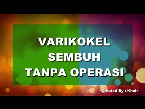 Patogen perempuan ramah Berarti untuk pengobatan potensi