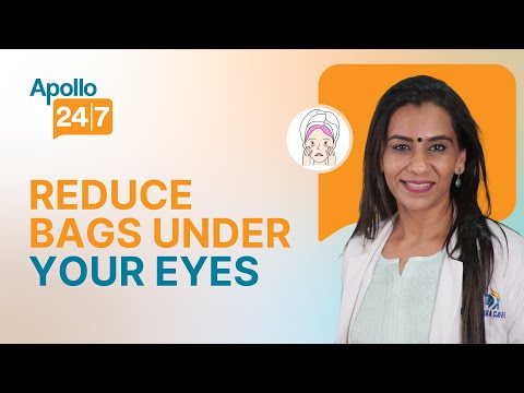 How do I Stop my Eyes from Watering Dr Shubhra Goel