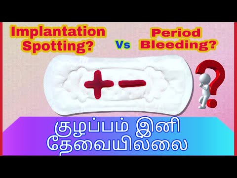 Implantation Bleeding VS PeriodBleeding in tamil/Periods VS Pregnancy Spotting in tamil/Implantation