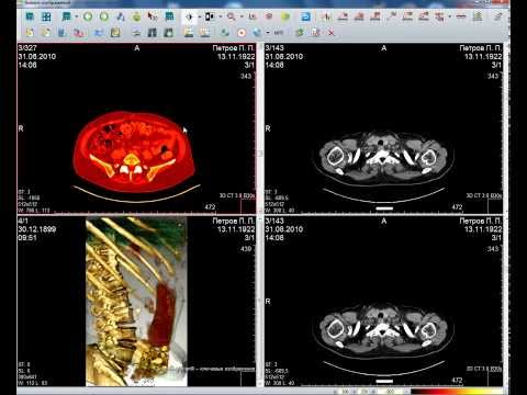 Видео руководство по работе с ПО 'АПК АрхиМед'