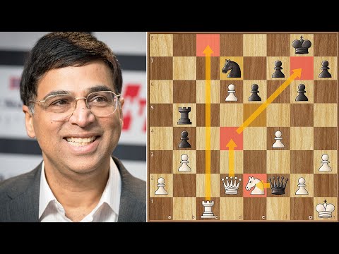 Anand Masterclass