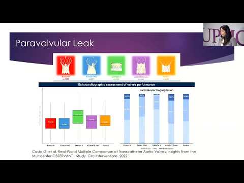 02 - Valve selection in TAVR: How do I decide? - Amber Makani, MD