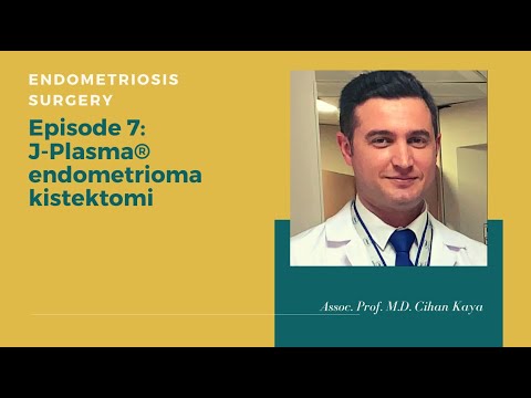 Endometriozis J-Plasma