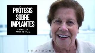 Sobredentadura sobre 4 implantes Testimonio