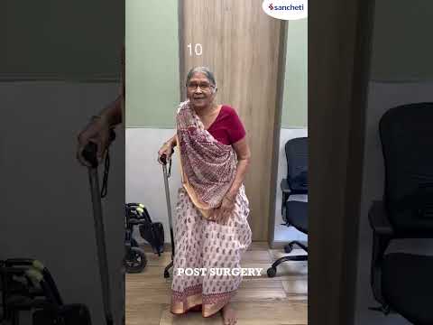 84 year old lady :Minimally Invasive Spine Surgery Changed Her Life | Dr. Ajay Kothari