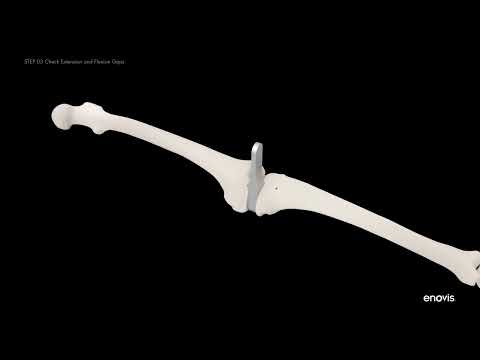Physica ZUK - Virtual Surgical Technique