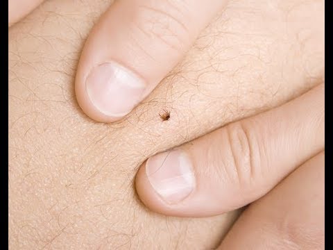 Come imparare quel gattino i vermi Mezzi da vermi a bambini 7