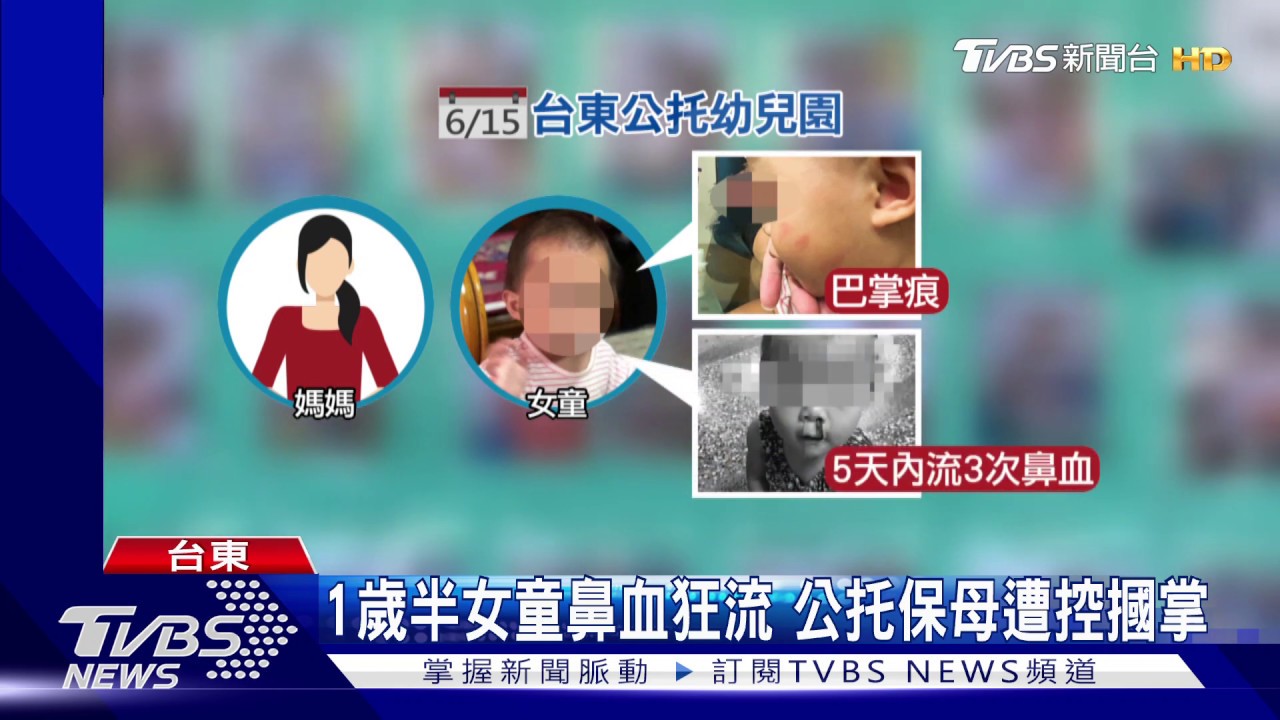 1歲半女童鼻血狂流 公托保母遭控摑掌