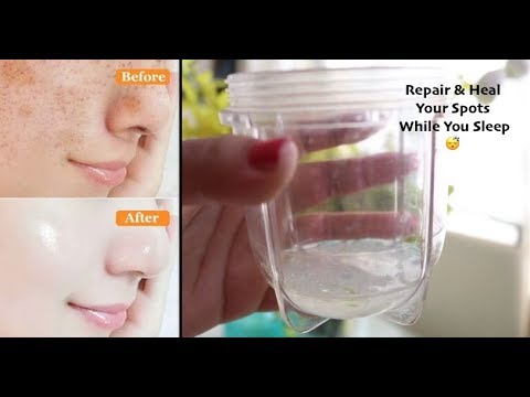 How to fade stubborn dark facial spots & freckles...