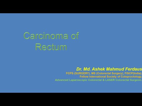 Rectal cancer