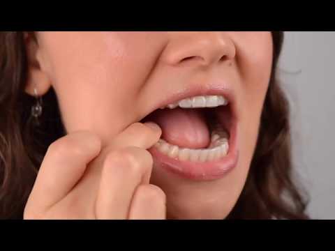Clear Correct - How clear aligners work