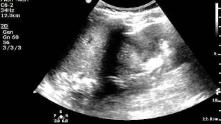 important renal findings