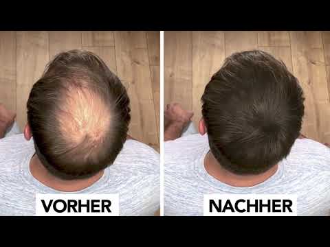 IMPERIO Streuhaar - Volles Haar in 20 Sekunden!