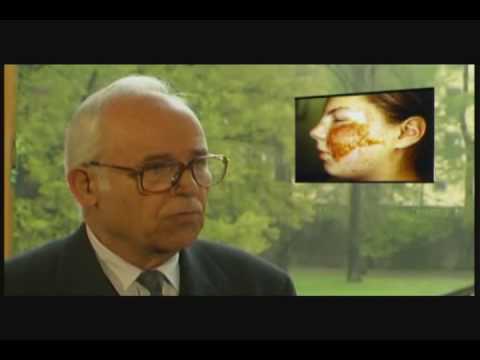 BioResonance Therapy Part 1