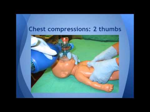 Resuscitation of Newborn Infants