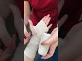 Figure 8 Bandaging Madilyn Rose