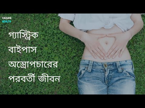 গ্যাস্ট্রিক বাইপাস অস্ত্রোপচারের পরবর্তী জীবন