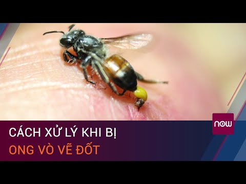 , title : 'Cách xử lý khi bị ong vò vẽ đốt, giảm nguy cơ tử vong | VTC Now'