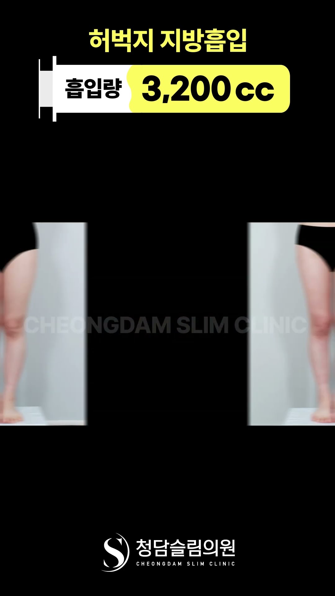 작년에 입었던 옷 안맞는다면?👯‍♀️