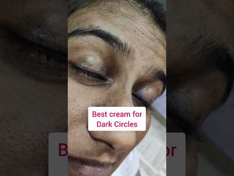 Best cream for dark circles before and after my eyes transformation #darkcircles #eyecream #eyegel