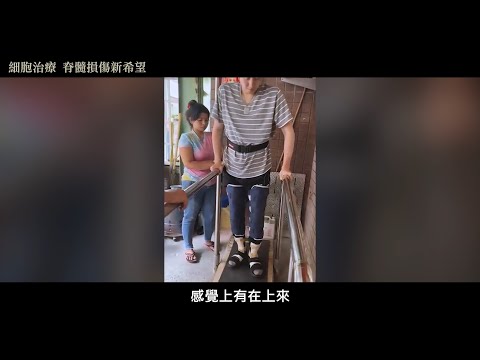 <p><a href="https://www.youtube.com/hashtag/%E8%84%8A%E9%AB%93%E6%90%8D%E5%82%B7"><span style="background-color:rgba(0,0,0,0.05);color:rgb(6,95,212);font-size:14px;">#脊髓損傷</span></a><span style="background-color:rgba(0,0,0,0.05);color:rgb(19,19,19);font-size:14px;"> 使他們的人生被迫按下暫停鍵&nbsp;</span></p><p><a href="https://www.youtube.com/hashtag/%E7%B4%B0%E8%83%9E%E6%B2%BB%E7%99%82"><span style="background-color:rgba(0,0,0,0.05);color:rgb(6,95,212);font-size:14px;">#細胞治療</span></a><span style="background-color:rgba(0,0,0,0.05);color:rgb(19,19,19);font-size:14px;"> 讓他們看到希望的曙光&nbsp;</span></p><p><span style="background-color:rgba(0,0,0,0.05);color:rgb(19,19,19);font-size:14px;">台中鍾先生，29歲&nbsp;</span></p><p><span style="background-color:rgba(0,0,0,0.05);color:rgb(19,19,19);font-size:14px;">「我原本胸部以下全癱，經由細胞治療，目前已可以靠輔具站起來復健。非常感謝光田醫院的陳子勇院長，在詳細的解說下，讓我了解治療的目的與方向，才能在漫長的復健過程支撐下去。」&nbsp;</span></p><p><span style="background-color:rgba(0,0,0,0.05);color:rgb(19,19,19);font-size:14px;">鍾先生接受 </span><a href="https://www.youtube.com/hashtag/%E8%87%AA%E9%AB%94%E9%AA%A8%E9%AB%93%E9%96%93%E8%B3%AA%E5%B9%B9%E7%B4%B0%E8%83%9E%E6%B2%BB%E7%99%82"><span style="background-color:rgba(0,0,0,0.05);color:rgb(6,95,212);font-size:14px;">#自體骨髓間質幹細胞治療</span></a><span style="background-color:rgba(0,0,0,0.05);color:rgb(19,19,19);font-size:14px;"> 過程&nbsp;</span></p><p><span style="background-color:rgba(0,0,0,0.05);color:rgb(19,19,19);font-size:14px;">110/03-因施工意外導致胸部以下全癱&nbsp;</span></p><p><span style="background-color:rgba(0,0,0,0.05);color:rgb(19,19,19);font-size:14px;">110/12-來院接受細胞治療評估，之後取髓&nbsp;</span></p><p><span style="background-color:rgba(0,0,0,0.05);color:rgb(19,19,19);font-size:14px;">111/02-月初，安排手術精準定位注射間質幹細胞，以及神經細胞生長輔助療法&nbsp;</span></p><p><span style="background-color:rgba(0,0,0,0.05);color:rgb(19,19,19);font-size:14px;">111/02-雙腳底有麻感, 雙大腿內側對痛刺激有感覺&nbsp;</span></p><p><span style="background-color:rgba(0,0,0,0.05);color:rgb(19,19,19);font-size:14px;">111/02-合併中醫接受針炙治療&nbsp;</span></p><p><span style="background-color:rgba(0,0,0,0.05);color:rgb(19,19,19);font-size:14px;">111/03-會陰部觸覺有感&nbsp;</span></p><p><span style="background-color:rgba(0,0,0,0.05);color:rgb(19,19,19);font-size:14px;">111/05-能以輔具站起，</span></p><p><span style="background-color:rgba(0,0,0,0.05);color:rgb(19,19,19);font-size:14px;">目前持續回診追蹤、復健並接受中醫治療&nbsp;</span></p><p><span style="background-color:rgba(0,0,0,0.05);color:rgb(19,19,19);font-size:14px;">把握黃金時間，愈早開始治療，恢復效果愈佳&nbsp;</span></p><p><span style="background-color:rgba(0,0,0,0.05);color:rgb(19,19,19);font-size:14px;">光田綜合醫院為全國第三家獲衛福部核准通過&nbsp;</span></p><p><span style="background-color:rgba(0,0,0,0.05);color:rgb(19,19,19);font-size:14px;">自體骨髓間質幹細胞治療之綜合醫院</span></p>