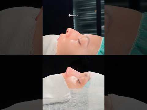 One nose a day. | Dr. med. Simon Zimmermann