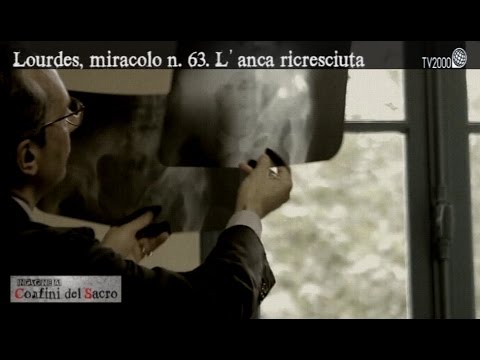 "Indagine ai confini del sacro" - Lourdes: Miracolo n.63, l’anca ricresciuta