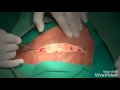 Baby Born Vedios