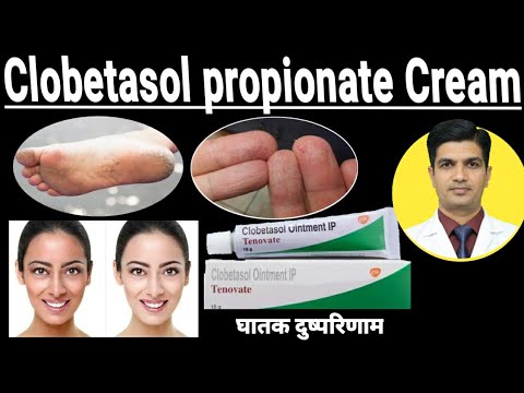 Clotic Clobetasol Lotion