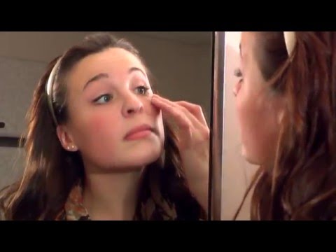 Lente escleral - Colocación, Retiro y Mantenimiento