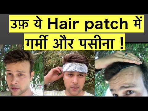HAIR PATCH SWEATING || HAIR PATCH FOR MEN || HAIR PATCH IN SUMMERS ||
