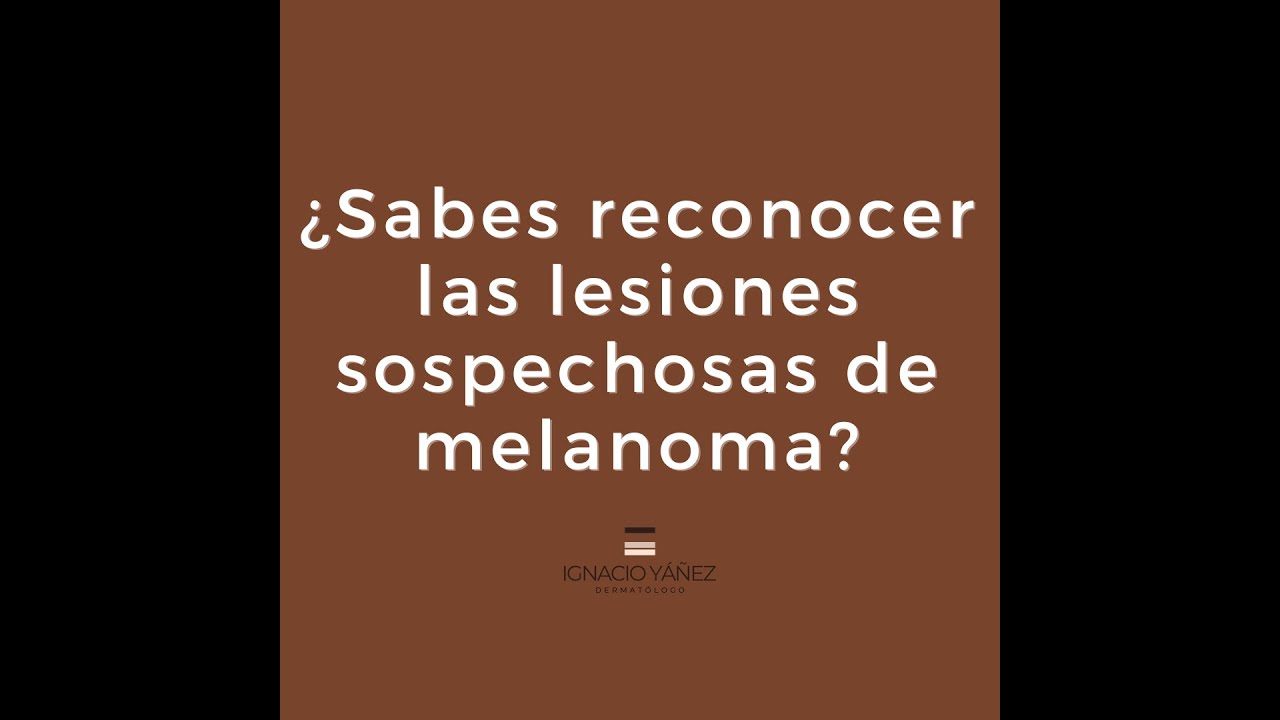 Ignacio Yáñez Silva-2