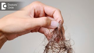 What are causes of severe hair fall like 100 strands daily? - Dr. Nischal K
