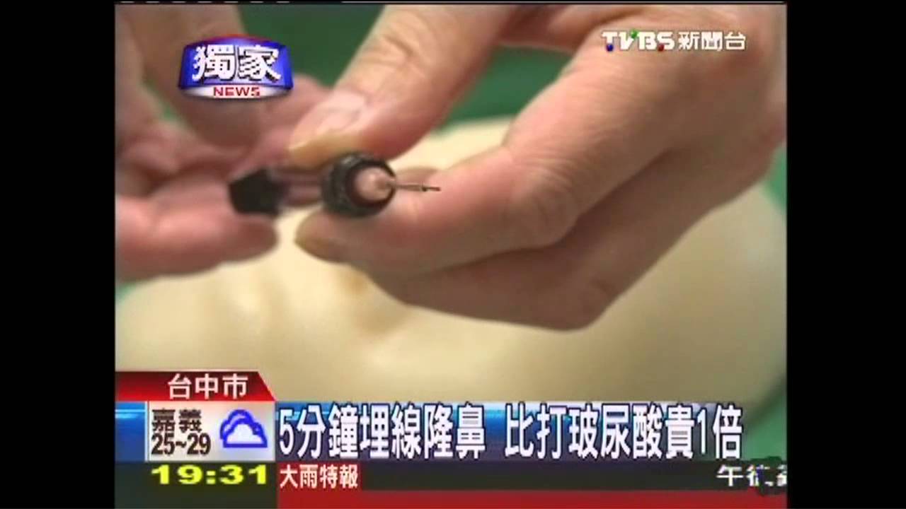〈獨家〉5分鐘埋線隆鼻 比打玻尿酸貴1倍