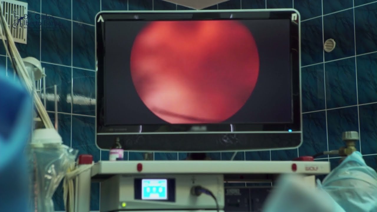 Carlos Alberto Barba Romero-6