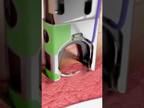 Automatic Surgical Stitch Devices! 😷 #goodtoknow #funfacts #vet #medicine #technology #suturing