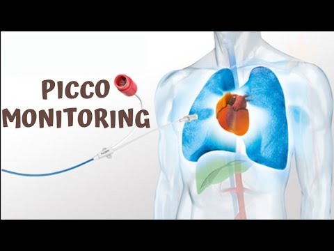 Picco Monitoring