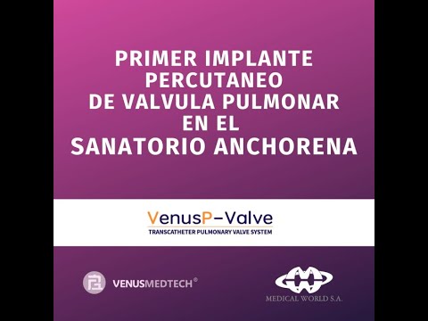 Implante percutáneo de Válvula Pulmonar / Sanatorio Anchorena