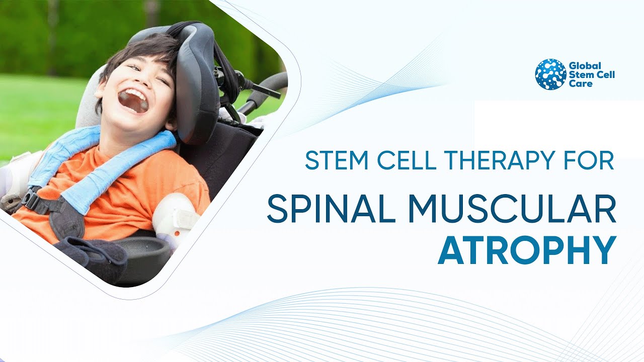 Breakthrough Stem Cell Treatment for Spinal Muscular Atrophy (SMA)
