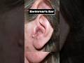 The #1 Worst Thing to Do for Ear Pain (Best Way to Avoid Swimmer’s Ear)