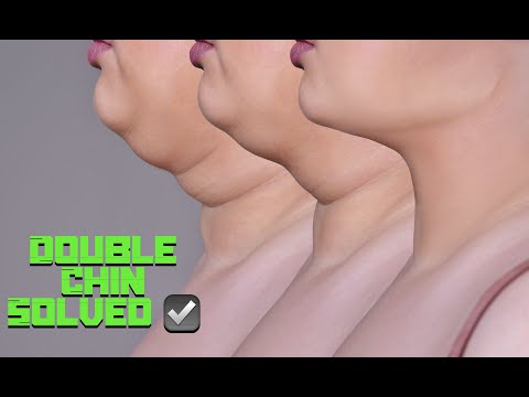 Double Chin? SOLVED ✔ (Eliminate Double Chin Fast) (Wiz Morphic Field)