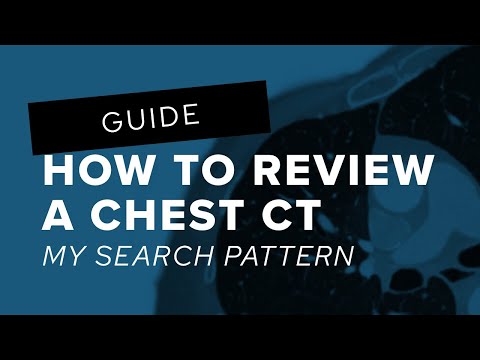 How to Review a Chest CT: My Search Pattern