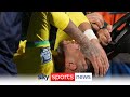 Neymar to undergo surgery after sustaining ligament injury