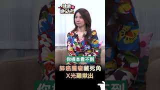 肺癌腫瘤藏死角 X光難揪出