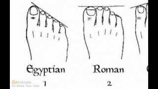Ancestry, Genealogy, and Shape of Your Toes (Based on this what are your roots?)