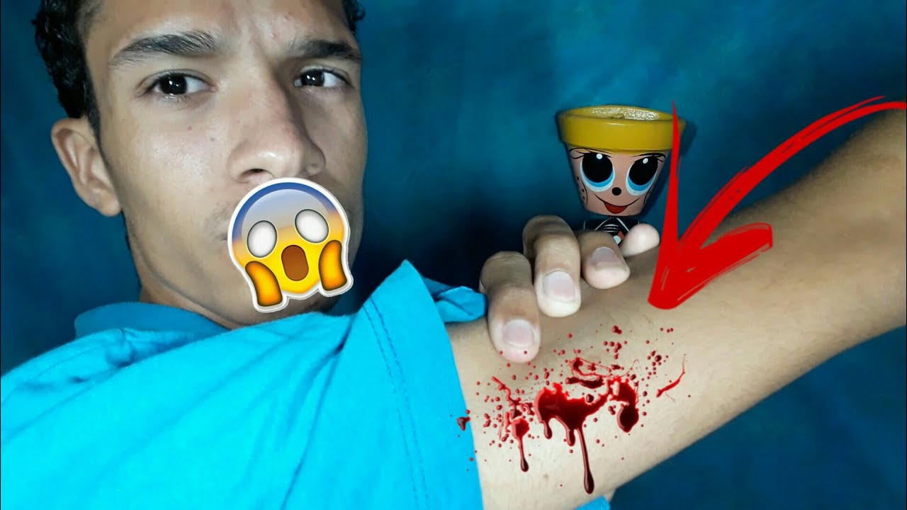 RASGUEI MEU BRAÇO NO VIDRO!